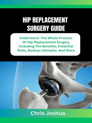 cover image of HIP REPLACEMENT SURGERY GUIDE